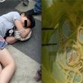 女子回國後肚子痛倒當場倒地！送醫檢查後又差點嚇暈過去，因為她的褲子裡滿滿都是.... 連醫生都看傻了！