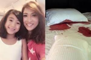 李詠嫻 6歲女兒深受這個皮膚病之苦。。，癢到把大腿抓破皮流血，床單都布滿血漬，李詠嫻崩潰痛哭“都是我的錯！”