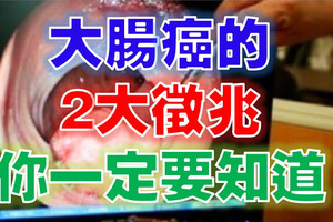 超可怕！「大腸癌」的2大徵兆你一定要知道 ! 晚看了後悔一輩子!!