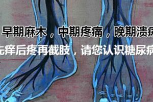 先癢後疼再截肢，請您認識糖尿病足，早期麻木，中期疼痛，晚期潰瘍