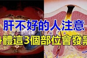 中醫師說：肝不太好的人，這3部位會發黑！只需多吃3種食物，肝會越來越好！