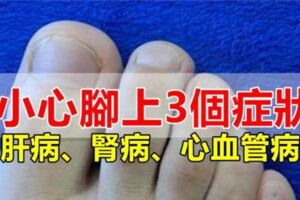 肝病、腎病、血管疾病看腳就知道，腳上出現3個症狀，要小心了