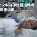 7歲男孩大火中為保護昏迷媽媽不離開被嚴重燒傷