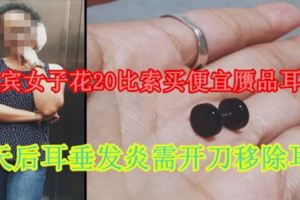 菲律賓女子花20比索買便宜贋品耳環戴數天後耳垂發炎需開刀移除耳環