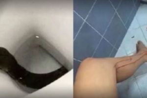 女子內急慌忙如廁，剛蹲下臀部一陣劇痛，低頭一看嚇暈。。。