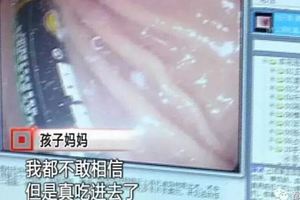 3歲寶寶內髒腐蝕發黑，家長後悔沒早扔掉它…很多家裡都有！