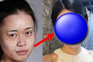 她視Angelababy為偶像「狠砸百萬整成她」！整完後真的變超美！但「醫生你整錯人了！」