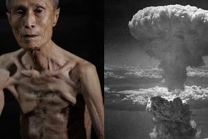 這位日本老爺爺親自展示當年原爆留下的駭人傷痕，就算過了70年後恐怖的記憶就好像昨天才發生一樣…