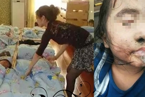 5歲幼童午睡再也沒醒來！老師叫他時，口鼻都流出黑色的膿液…竟然只是因為「這件事」！！