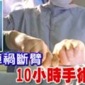 馬勞車禍斷臂10小時手術接回