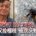 全身都被叮臉上30腫包老漢撿榴槤被虎頭蜂蜇死