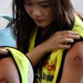 反送中港民遍地開花！8區示威 女記者中催淚彈左臂受傷
