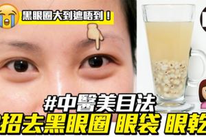 改善黑眼圈眼袋浮腫眼乾紅筋！5招食療穴位按摩