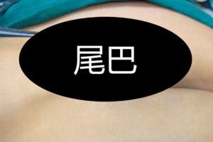 父母發現剛出生的兒子「多了一條尾巴」後耿耿於懷，但是婆婆一句話竟讓他們笑到爽死！