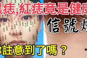 黑痣、紅痣竟是健康「信號燈」，你注意到了嗎？