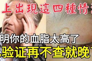 身上出現這四種情況，說明你的血脂太高了！已驗證再不查就晚了！
