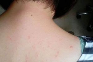 秋天洗澡，用肥皂還是沐浴露好？很多人都做錯，難怪後背發癢長痘