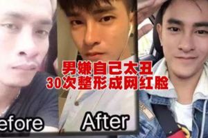 男嫌自己太醜30次整形成網紅臉