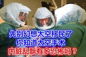 先別幻想太空移民了，你知道太空手術內髒亂飄有多恐怖嗎？