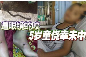 遭眼鏡蛇咬5歲童僥幸未中毒!