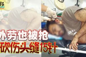 外勞也被搶遭砍傷頭縫15針!