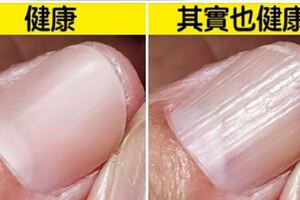 折手指≠關節炎！　12個其實「不用被網路嚇到」的正常生理狀況