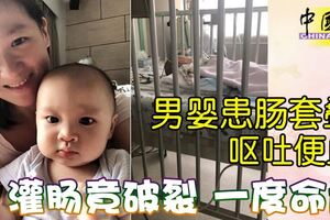 男嬰患腸套疊嘔吐便血灌腸竟破裂一度命危