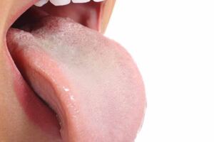 體內有病，舌頭告知？若舌頭出現5種現象，是時候警惕這些疾病