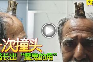 一次撞頭老翁長出「魔鬼的角」