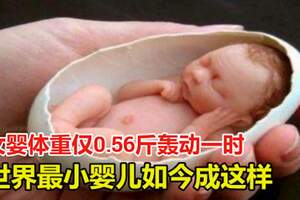 女嬰體重僅0.56斤轟動一時，被稱為世界上最小的嬰兒，她如今成這樣