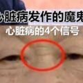 心髒病只挑時間不挑人，5個魔鬼時間需警惕，你都知道嗎？