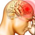 許多人都以為偏頭痛沒什麼根本不當一回事，但醫生警告「你很可能有一顆過敏的大腦」！