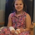 這個小女孩「在家被蜘蛛咬傷」後情況開始失控，去到醫院時醫生都對著她的傷口看呆了…