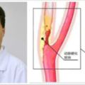 頭暈迷糊、行動困難引發中風，病根竟出在脖子上？！