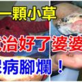 一顆小草竟治好了婆婆糖尿病腳爛（就算爛腳也治得好而且傷口也癒合）請轉分享給身邊朋友吧