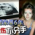 男子遭女友家暴6年，斷齒燙傷不分手，還打算將他的經歷拍攝成紀錄片