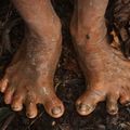 世上最原始人類部落　手腳進化形狀驚人