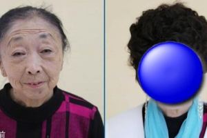 為了嫁給37歲年輕帥哥，71歲老婆婆傾家蕩產「整成年輕少婦」，前後變化太大了!