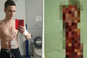 24歲青年一天「狂嘔30次」還以為是嚴重流感，但最後看診時醫生卻說要剪掉他「這個」…