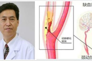 頭暈迷糊、行動困難引發中風，病根竟出在脖子上？！