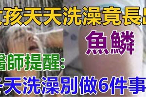 女孩天天洗澡竟長出「魚鱗」！醫生提醒：冬天洗澡別做這「6件事」！