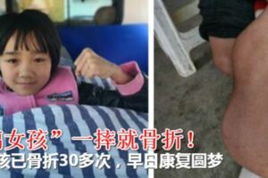 一摔就骨折！「玻璃女」12歲女孩已骨折30多次，早日康復圓夢