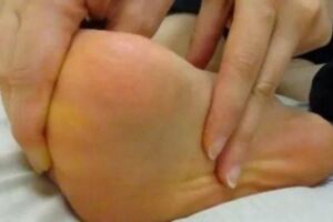 一下床踩地腳就會痛？小心患上「足底筋膜炎」教你這3招一生受用