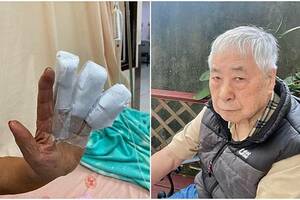 86歲李富城為吃包子「3根手指遭壓扁」 親吐驚魂過程