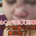 【GrabCar司機又鬧事了！】16歲少女慘遭司機揮拳！鼻樑斷了！