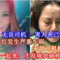 【無良司機·害人害己！】大馬女網紅發生嚴重車禍，無良司機撞後逃跑！網紅：「我一起來，才發現我破相和腳斷！」