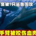 少年釣魚被7隻鯊魚圍攻手臂被咬傷血肉模糊!