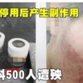 護膚品停用後產生副作用　料500人遭殃！