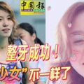 整牙成功！「洪荒少女」傅園慧不一樣了！