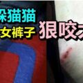 老鼠躲貓貓鑽入少女褲子狠咬大腿